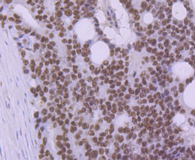 Anti-PRPF8 Antibody (4V102)