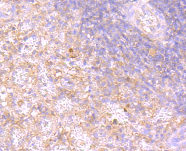 Anti-RAC1/2/3 Antibody (1M237)