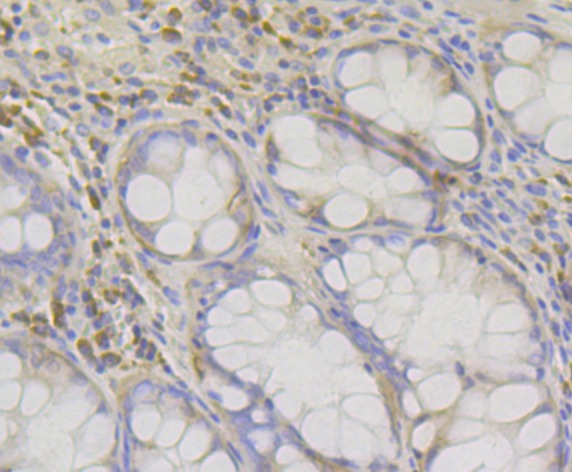 Anti-Rack1 Antibody (8C519)