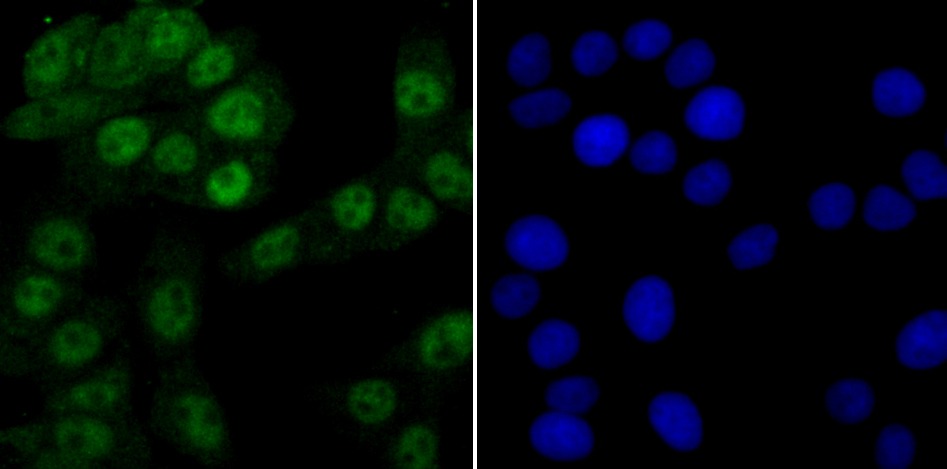 Anti-PRPF8 Antibody (4V102)