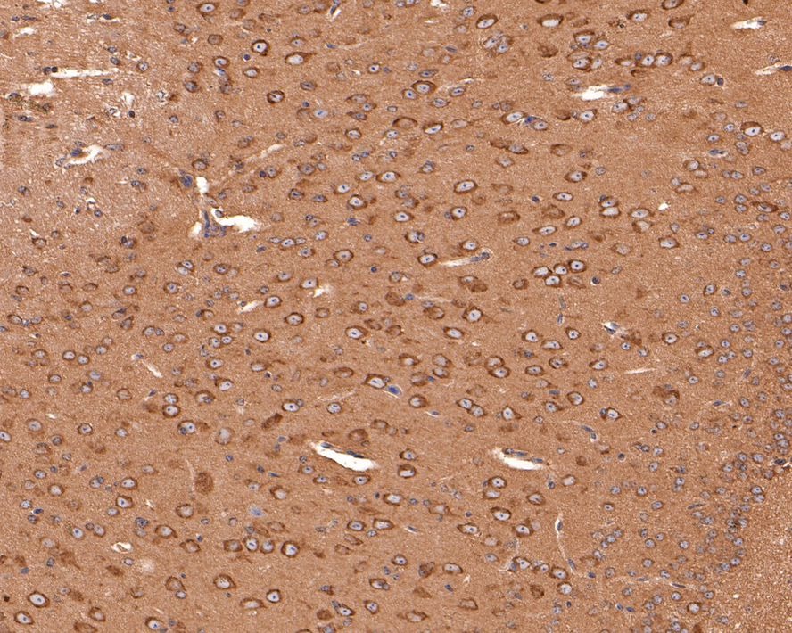 Anti-PIEZO1 Antibody (9P32)