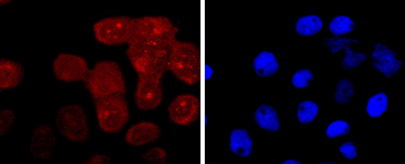 Anti-RAGE Antibody (3H335)