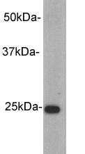 Anti-Rabbit IgG κ Light Chain Antibody (4V598)