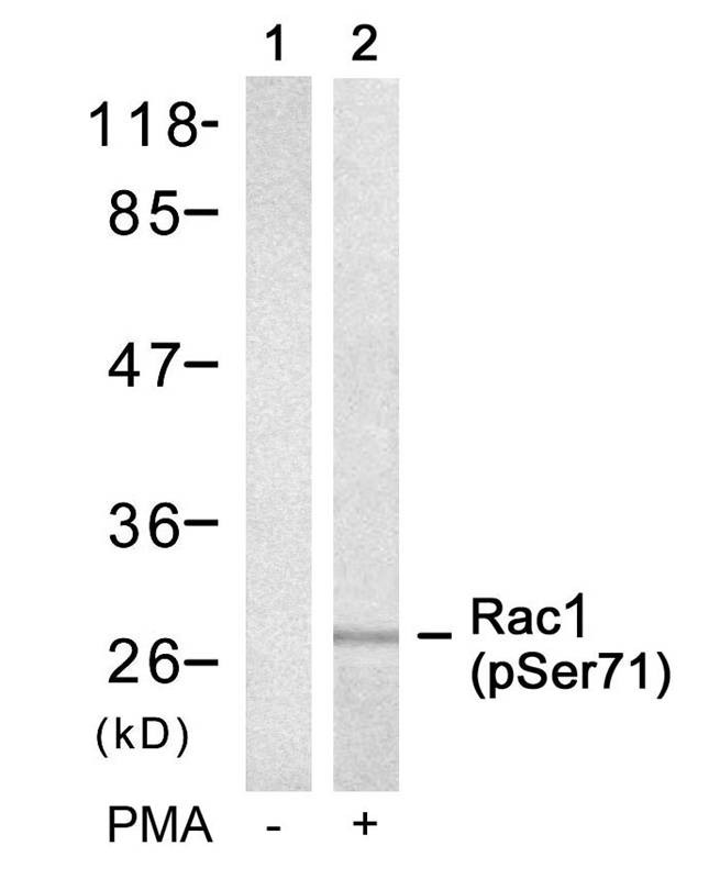 Anti-Phospho-RAC1 (Ser71) Polyclonal Antibody