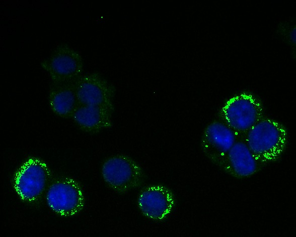 Anti-RanGAP1 Antibody (8X592)