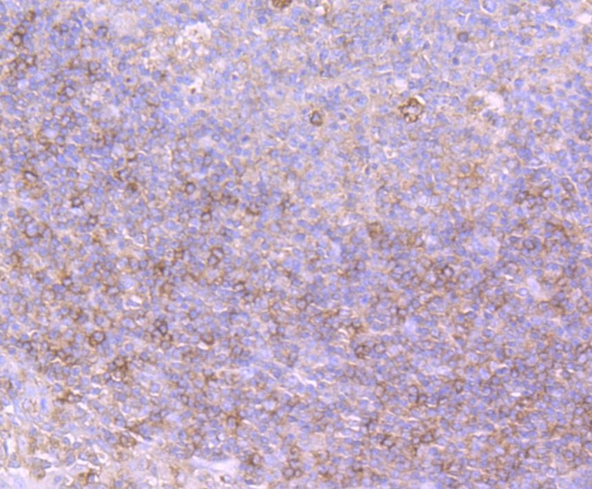 Anti-Protein Kinase D2/PRKD2 Antibody (5O381)