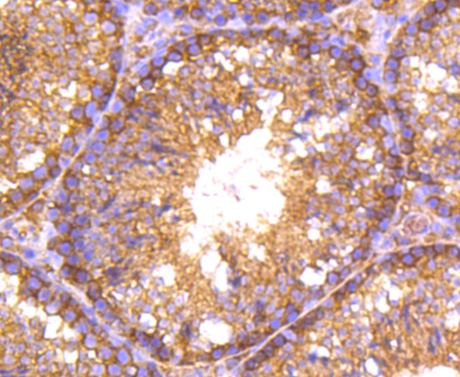 Anti-RALBP1 Antibody (4R123)