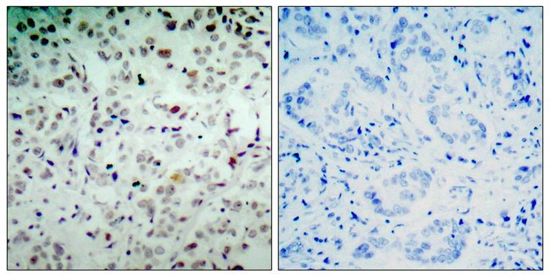 Anti-Phospho-RB1 (Ser780) Polyclonal Antibody