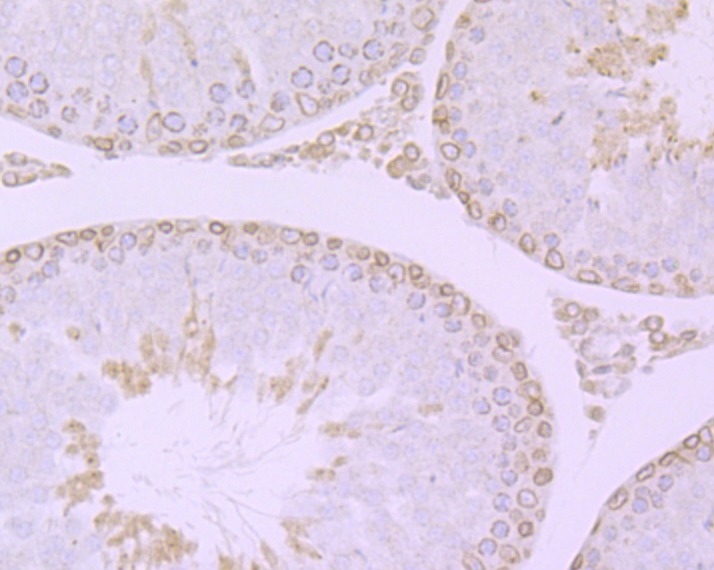 Anti-RanGAP1 Antibody (8X592)