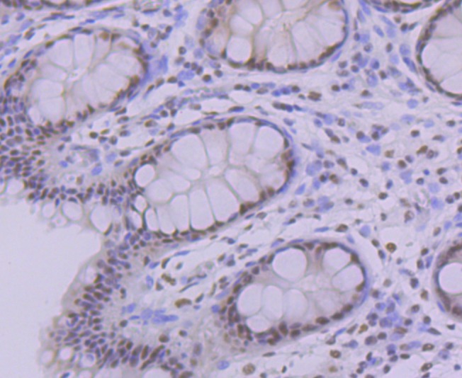 Anti-PRPF8 Antibody (4V102)