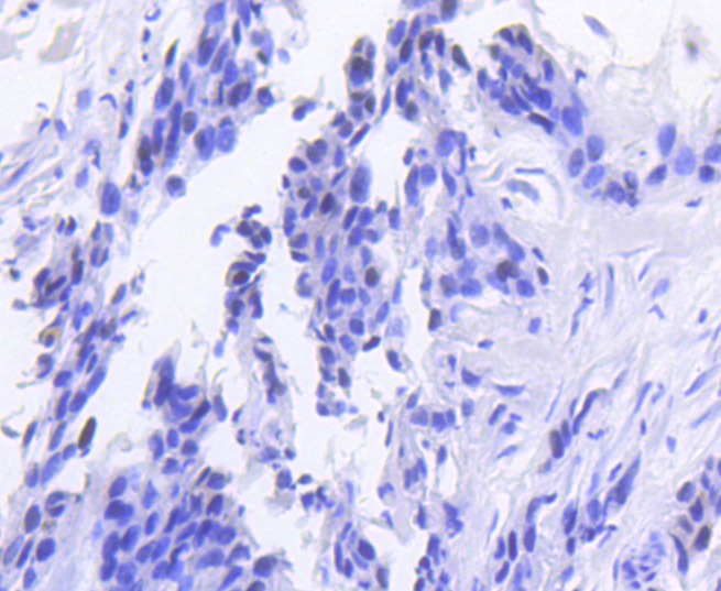 Anti-RB1 Antibody (6K434)