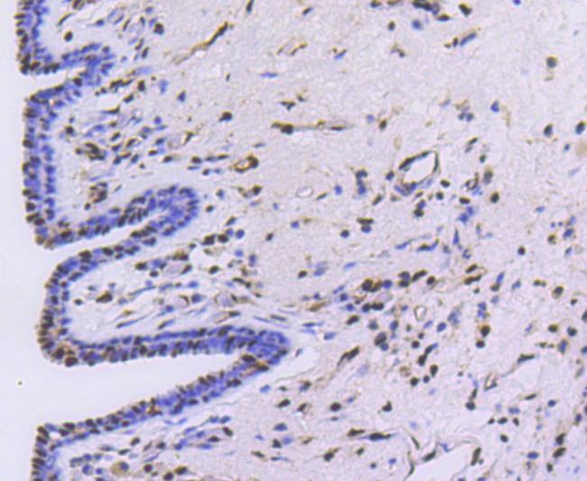 Anti-PRP19 Antibody (7U313)