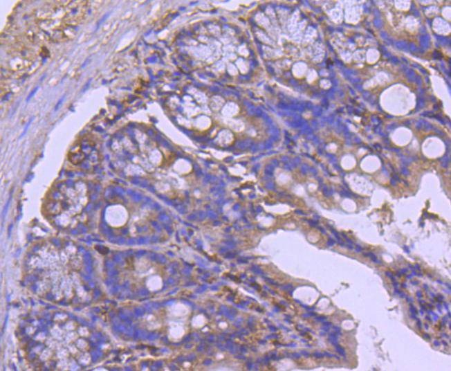 Anti-PTEN Antibody (9S478)