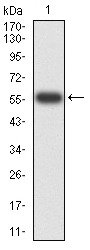 Anti-PTPN14 Antibody (8D656)