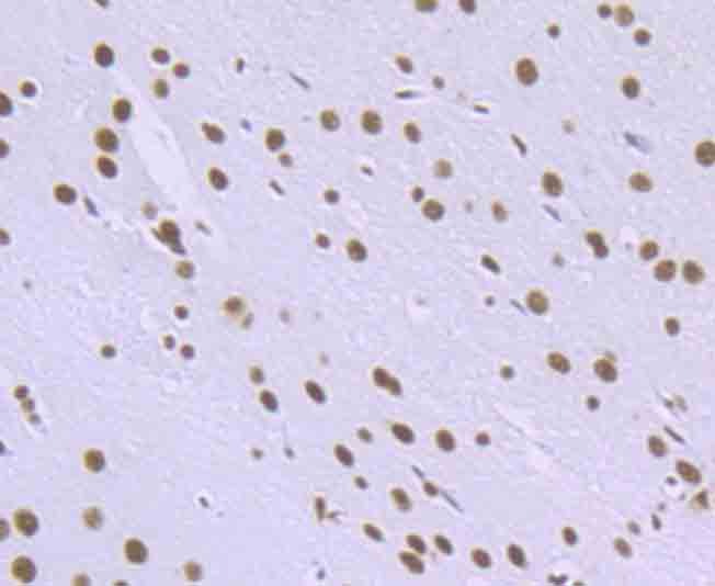Anti-RBBP4 Antibody (7R532)