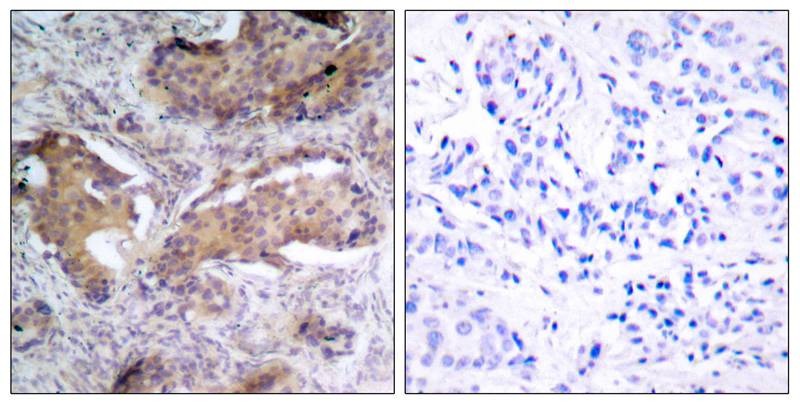 Anti-Phospho-PTEN (Ser370) Polyclonal Antibody