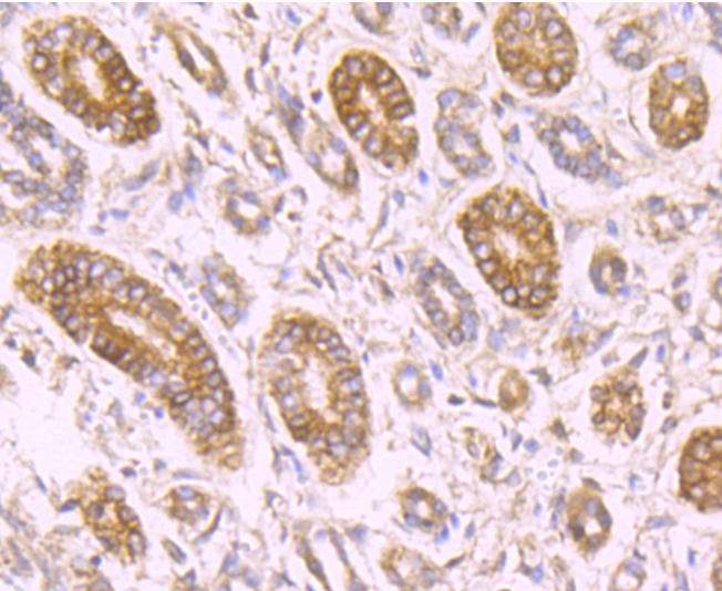 Anti-RBP4 Antibody (2C142)