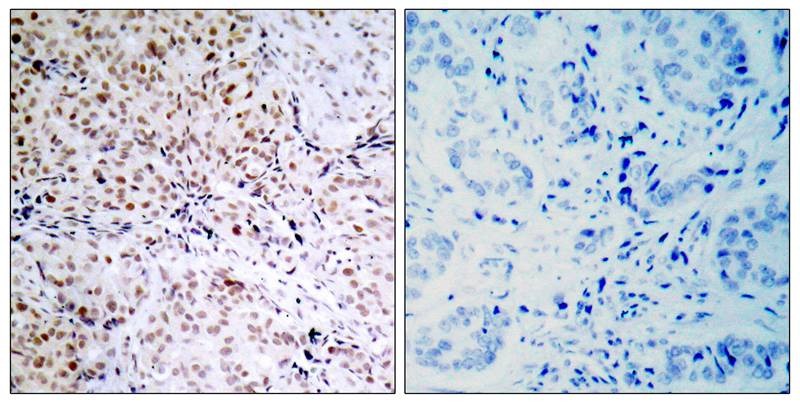 Anti-Phospho-RB1 (Ser795) Polyclonal Antibody