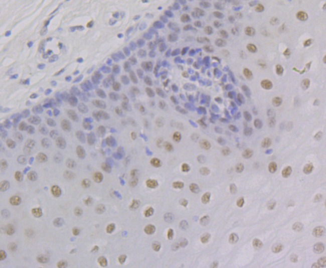 Anti-Retinoid X Receptor alpha Antibody (8D993)