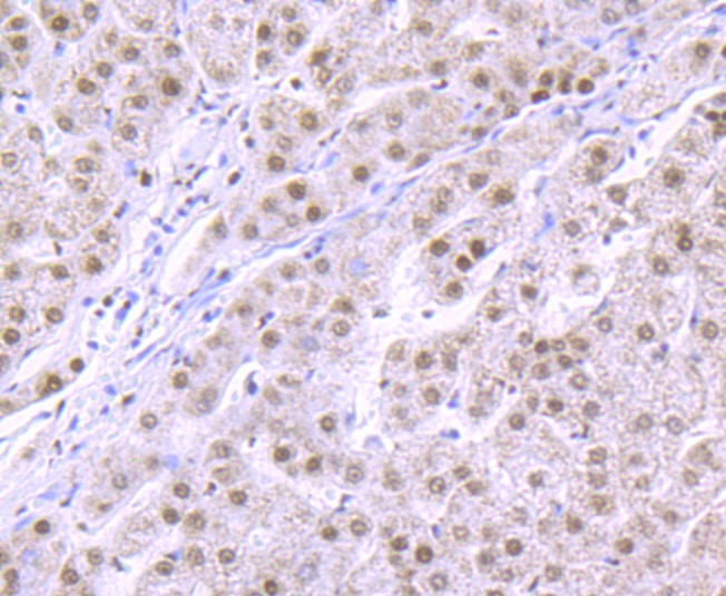 Anti-RBBP4 Antibody (7R532)