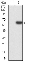 Anti-PTPN14 Antibody (8D656)