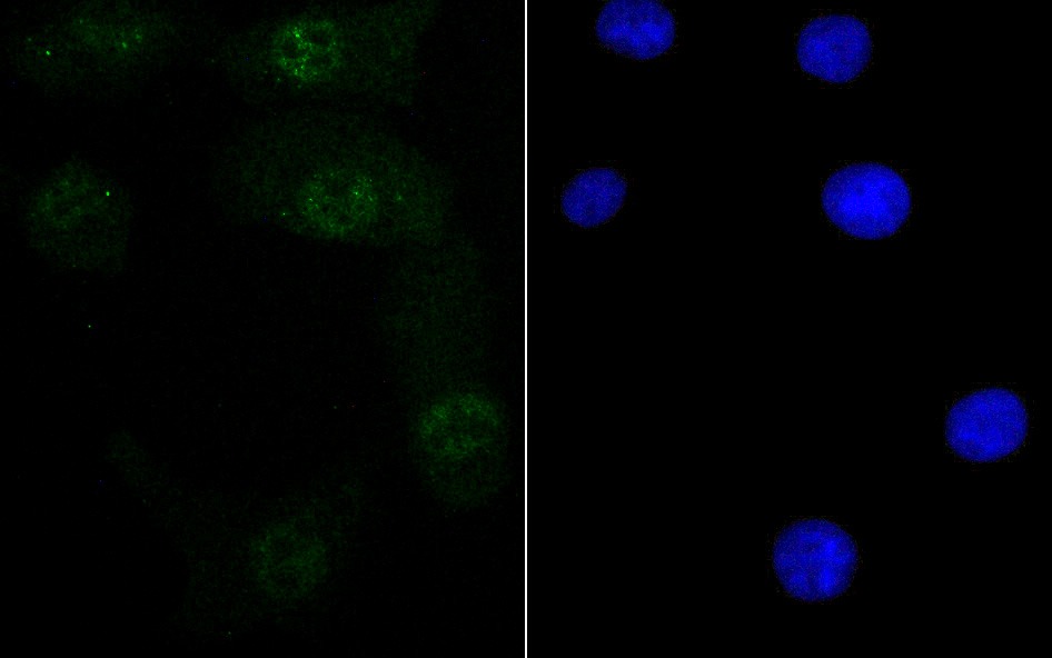 Anti-Retinoid X Receptor alpha Antibody (8D993)