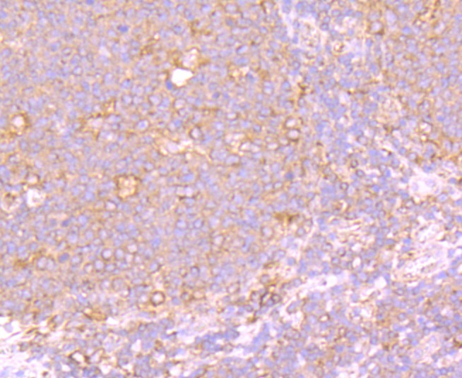 Anti-PTP1B Antibody (4L780)