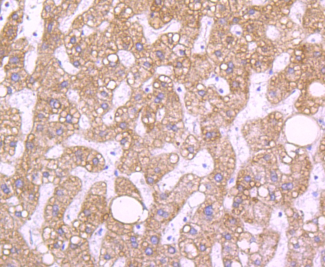 Anti-RBP4 Antibody (2C142)