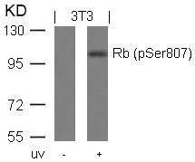 Anti-Phospho-RB1 (Ser807) Polyclonal Antibody