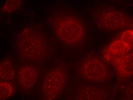 Anti-Phospho-PTEN (Ser370) Polyclonal Antibody