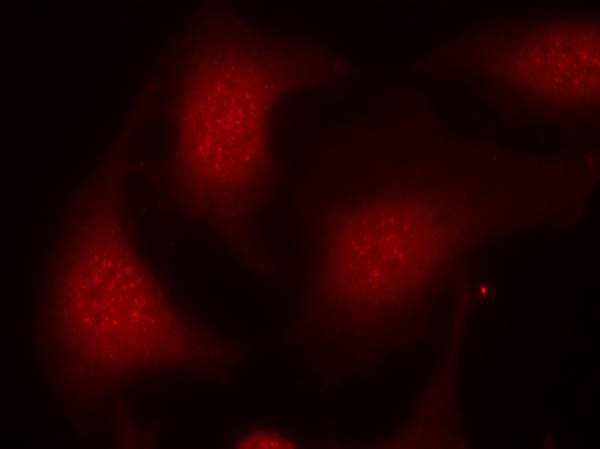 Anti-Phospho-RB1 (Ser795) Polyclonal Antibody