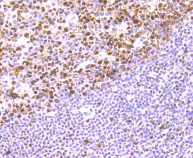 Anti-RBBP4 Antibody (7R532)