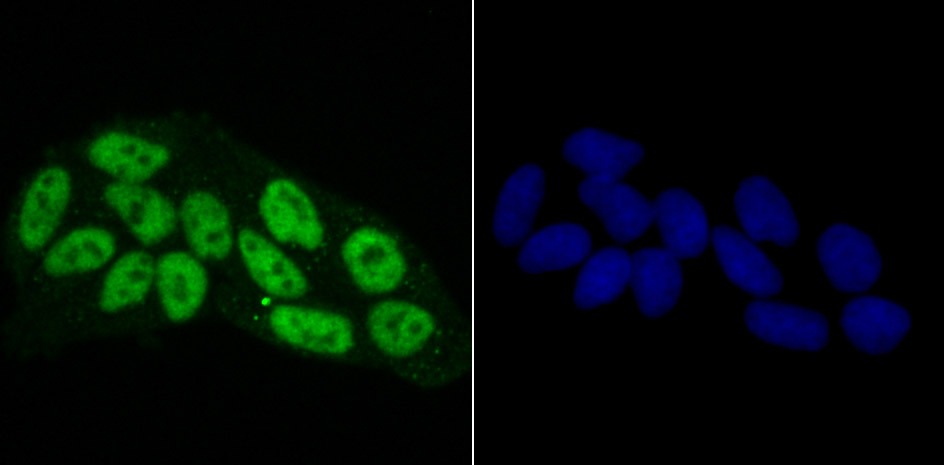 Anti-RBBP4 Antibody (7R532)