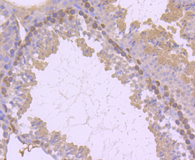 Anti-PRKCD Antibody (8E672)