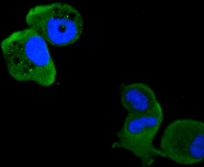 Anti-PRKCD Antibody (8E672)