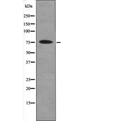 Anti-Phospho-PKC beta (Ser660) Polyclonal Antibody