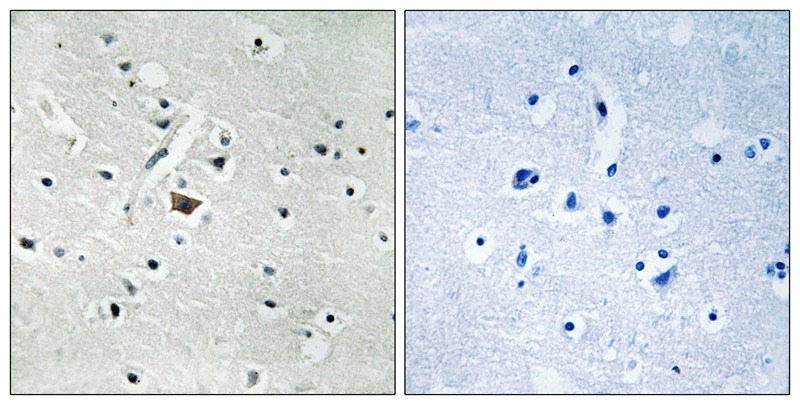 Anti-Phospho-PLD2 (Tyr169) Polyclonal Antibody
