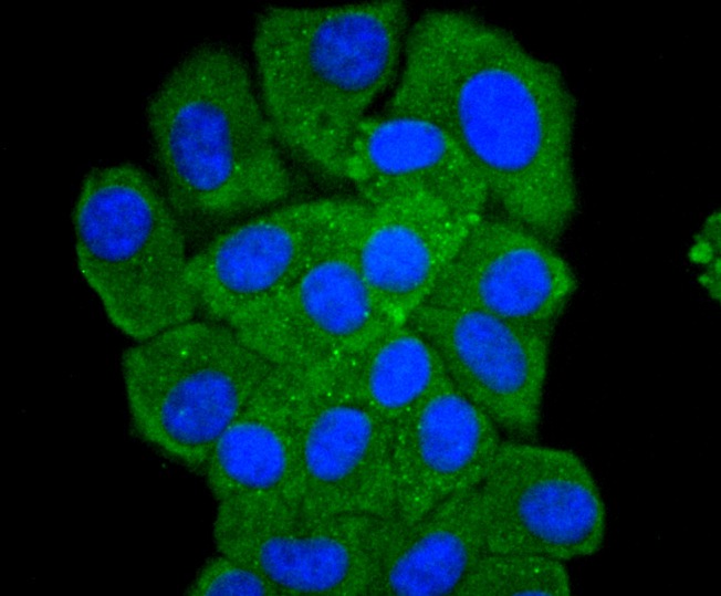 Anti-PRKCD Antibody (8E672)