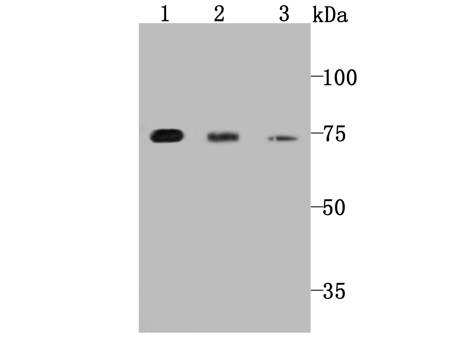 Anti-PKCE Antibody (5H978)
