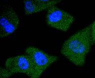 Anti-Kallikrein 3/KLK3 Antibody (4P120)