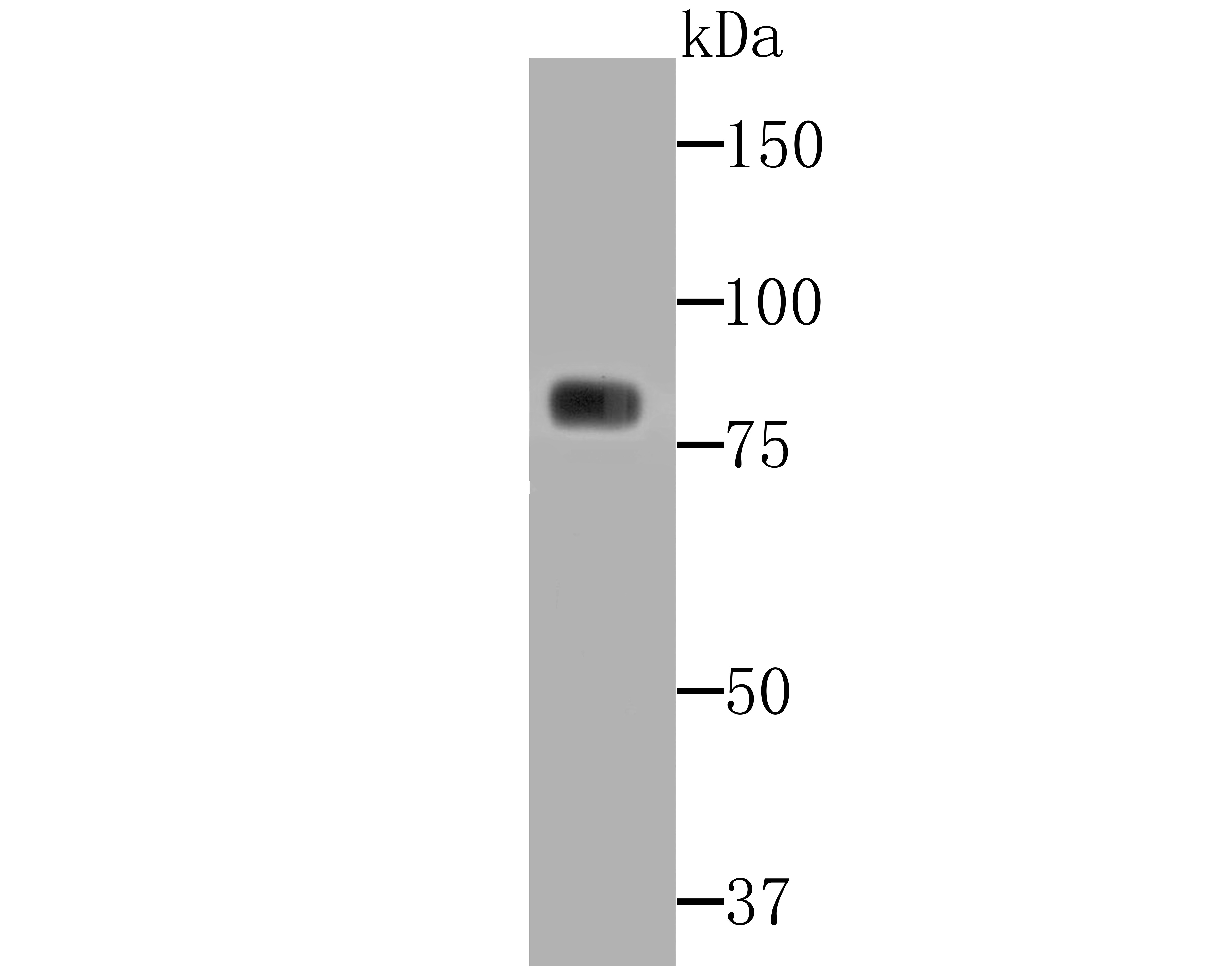 Anti-PKC gamma Antibody (9I127)