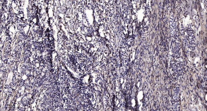 Anti-Phospho-PLCg2 (Tyr759) Polyclonal Antibody