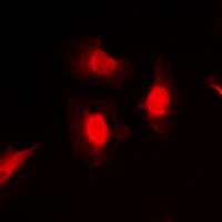Anti-Phospho-PKC iota/PRKCZ (Thr412/410) Polyclonal Antibody