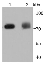 Anti-PRKCD Antibody (8E672)