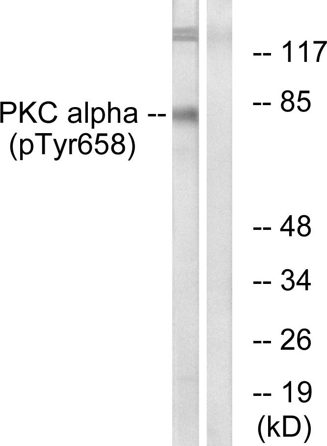 Anti-Phospho-PRKCA (Tyr658) Polyclonal Antibody