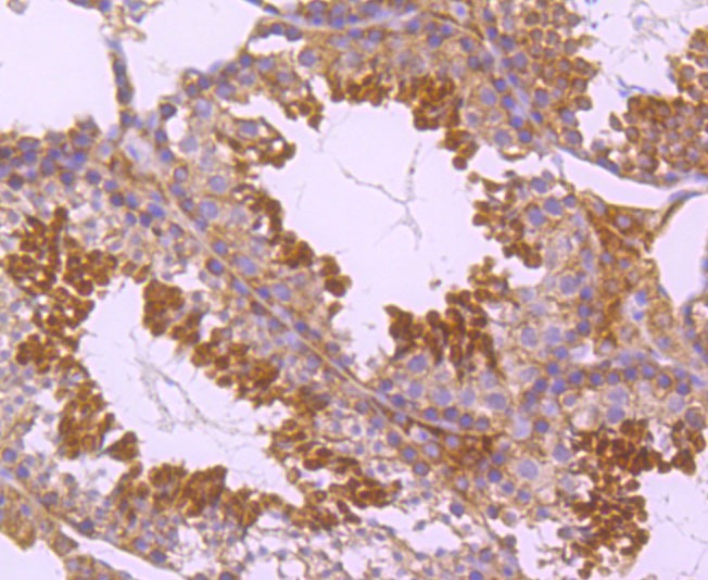 Anti-PKCE Antibody (5H978)