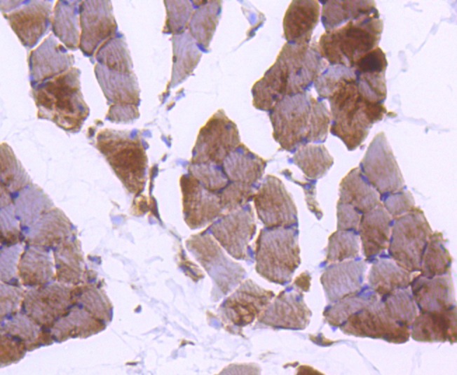 Anti-Plectin Antibody (4J312)