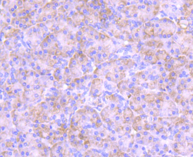 Anti-PKCE Antibody (5H978)