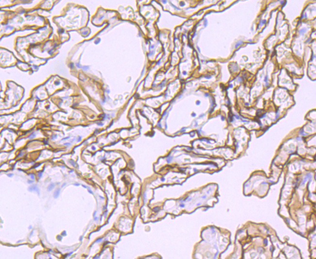 Anti-Podoplanin Antibody (9X102)