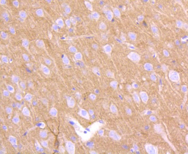 Anti-PRNP/Prion Antibody (2B223)